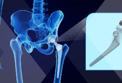 3 d打印技术在医疗保健个人