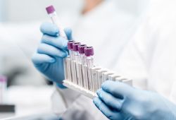 个性化医疗保健的伴随诊断关键