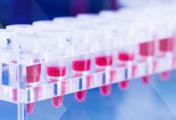 什么是液体活检?精准医疗的未来工具。